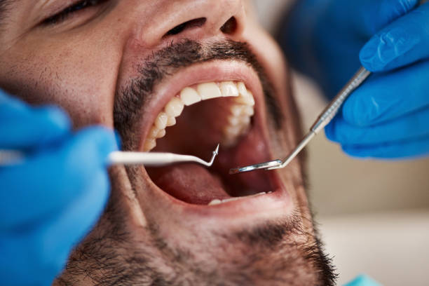 Best Broken or Chipped Tooth Repair in Hubbard, OH